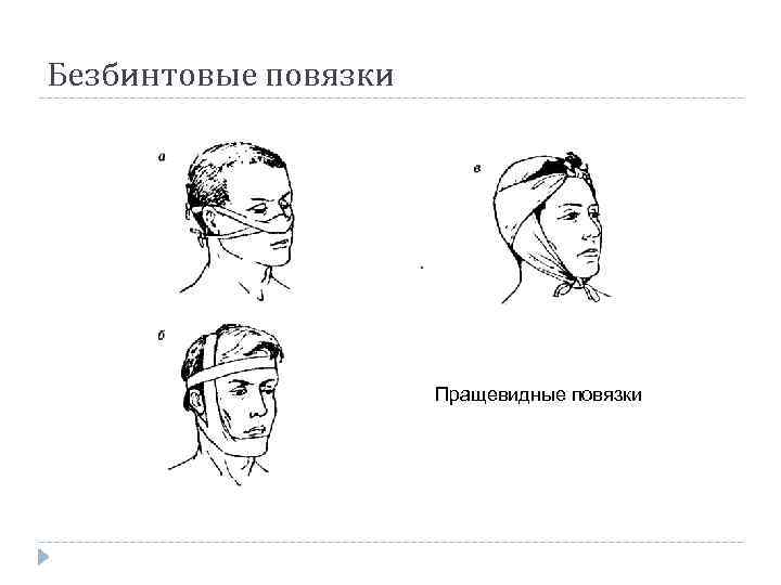 Безбинтовые повязки Пращевидные повязки 