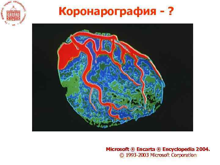 Коронарография - ? Microsoft ® Encarta ® Encyclopedia 2004. © 1993 -2003 Microsoft Corporation