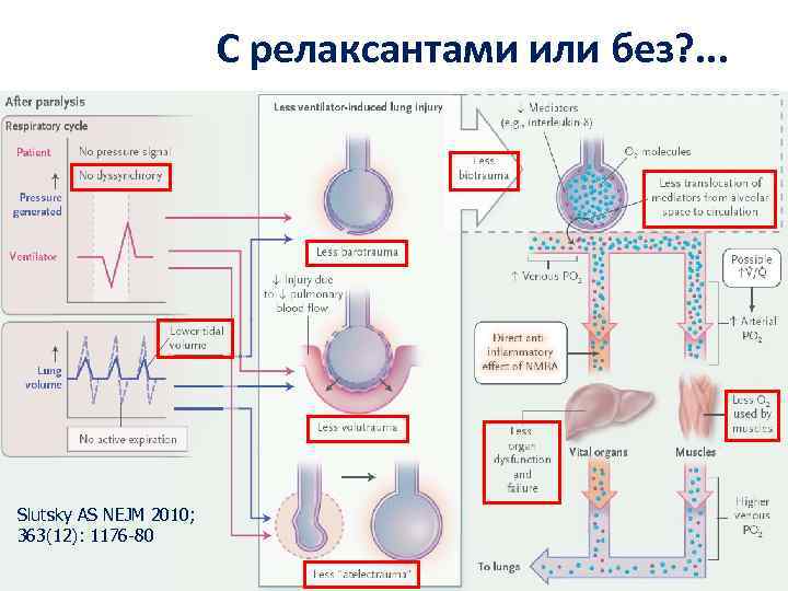 С релаксантами или без? . . . Slutsky AS NEJM 2010; 363(12): 1176 -80
