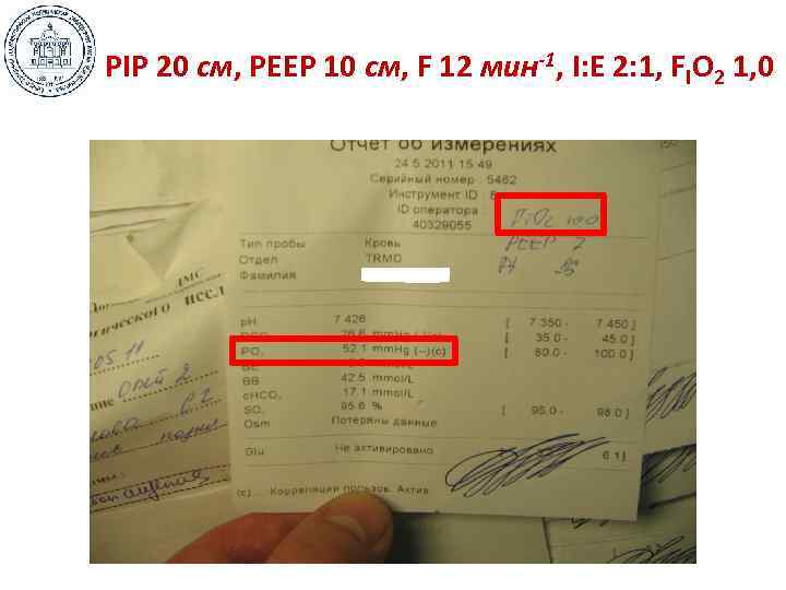 РIP 20 см, РЕЕР 10 см, F 12 мин-1, I: E 2: 1, FIO