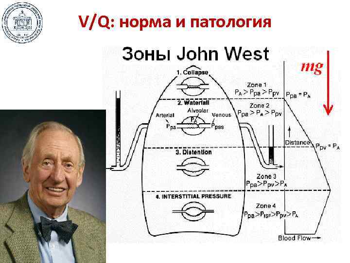 V/Q: норма и патология 