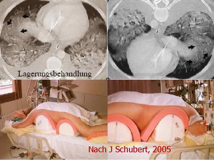 Nach J Schubert, 2005 