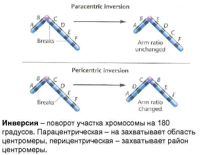 Инверсия – поворот участка хромосомы на 180 градусов. Парацентрическая – на захватывает область центромеры,