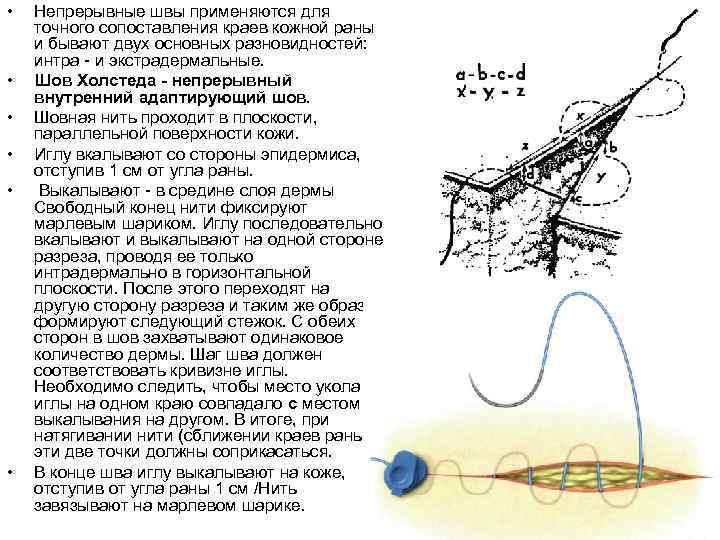  • • • Непрерывные швы применяются для точного сопоставления краев кожной раны и