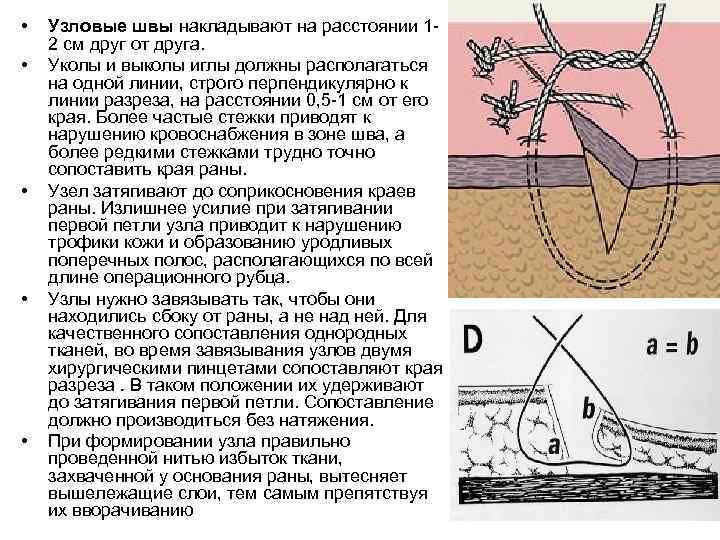 • • • Узловые швы накладывают на расстоянии 12 см друг от друга.