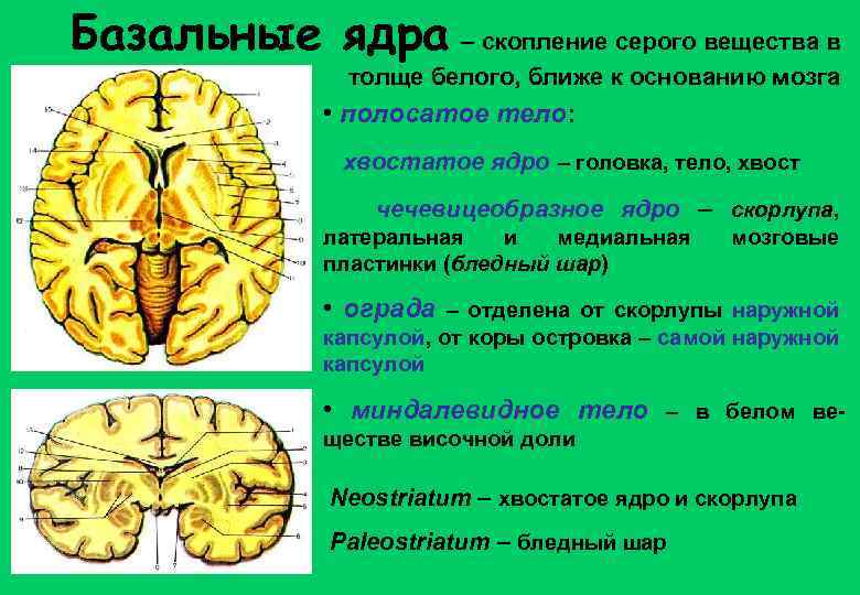 Расширение в базальных ядрах