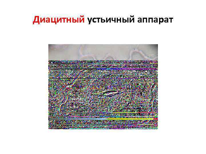 Диацитный устьичный аппарат 