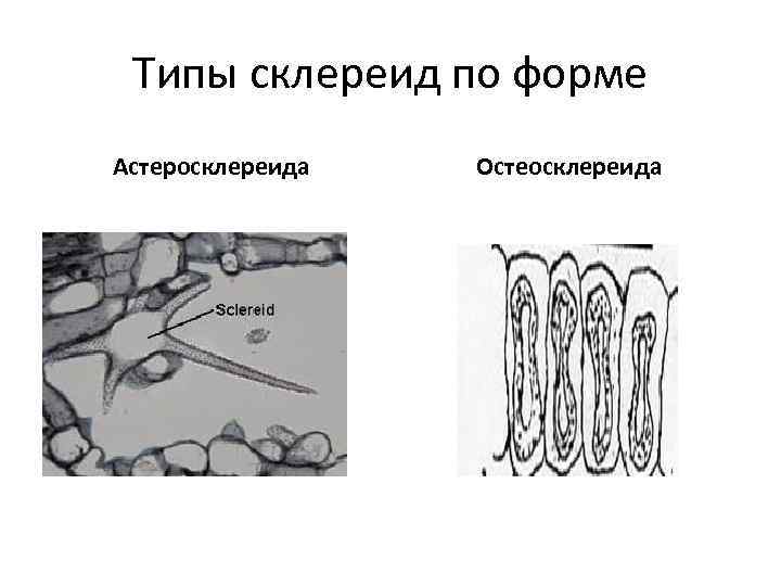 Типы склереид по форме Астеросклереида Остеосклереида 