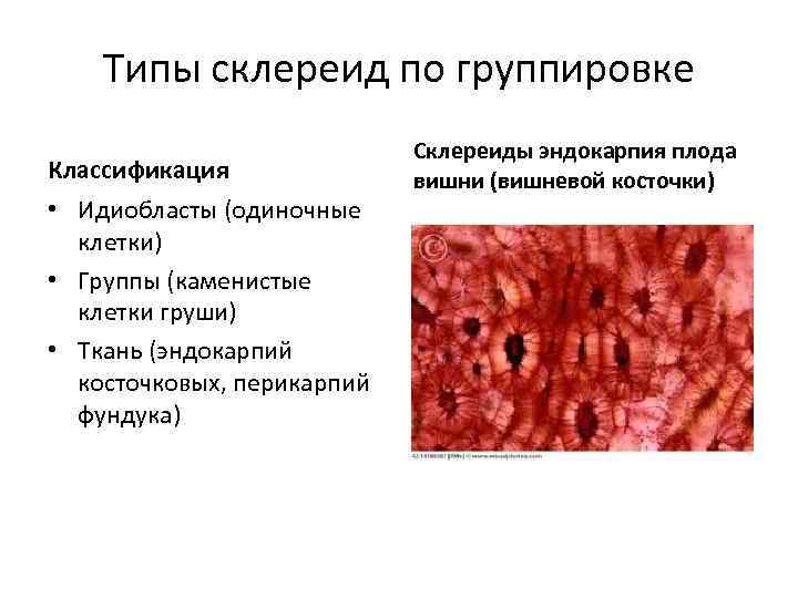 Типы склереид по группировке Классификация • Идиобласты (одиночные клетки) • Группы (каменистые клетки груши)
