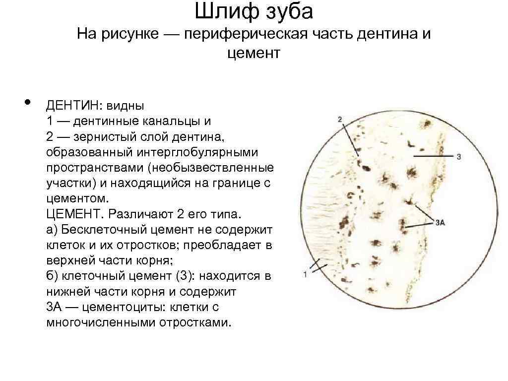 Шлиф зуба На рисунке — периферическая часть дентина и цемент • ДЕНТИН: видны 1