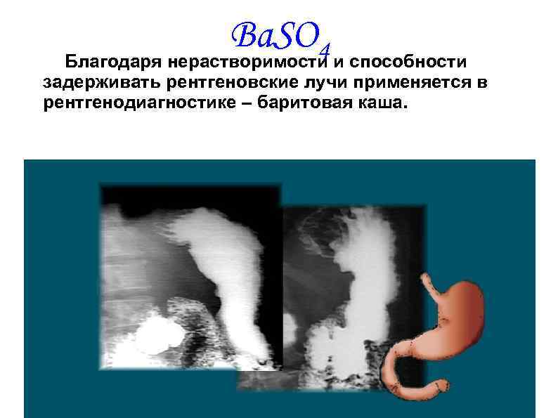 Ba. SO 4 Благодаря нерастворимости и способности задерживать рентгеновские лучи применяется в рентгенодиагностике –
