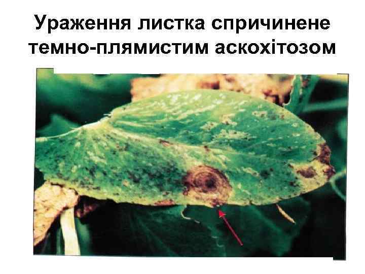 Ураження листка спричинене темно-плямистим аскохітозом 