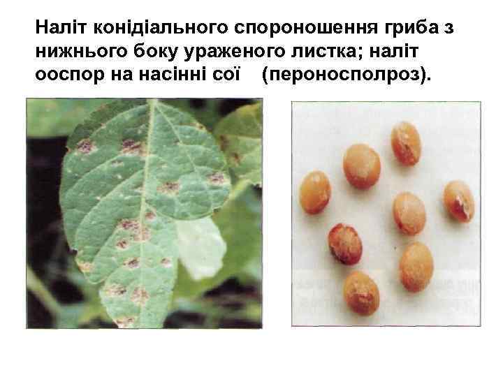 Наліт конідіального спороношення гриба з нижнього боку ураженого листка; наліт ооспор на насінні сої