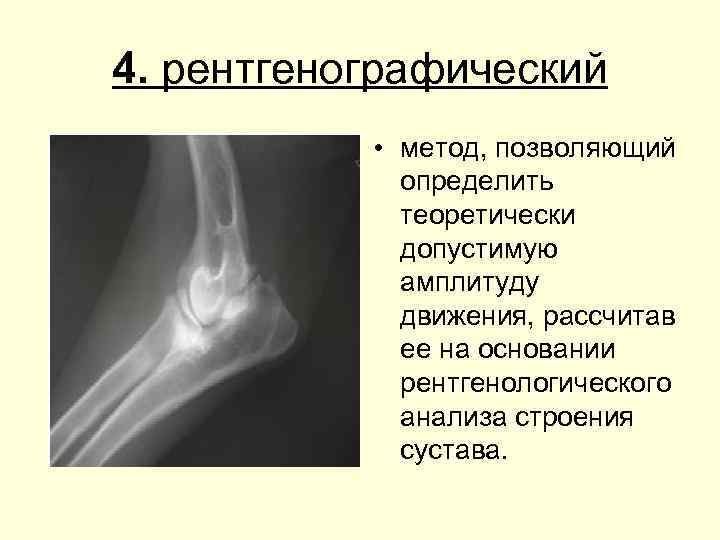 4. рентгенографический • метод, позволяющий определить теоретически допустимую амплитуду движения, рассчитав ее на основании