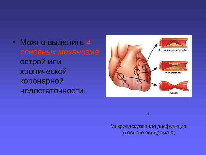  • Можно выделить 4 основных механизма острой или хронической коронарной недостаточности. + Микроваскулярная