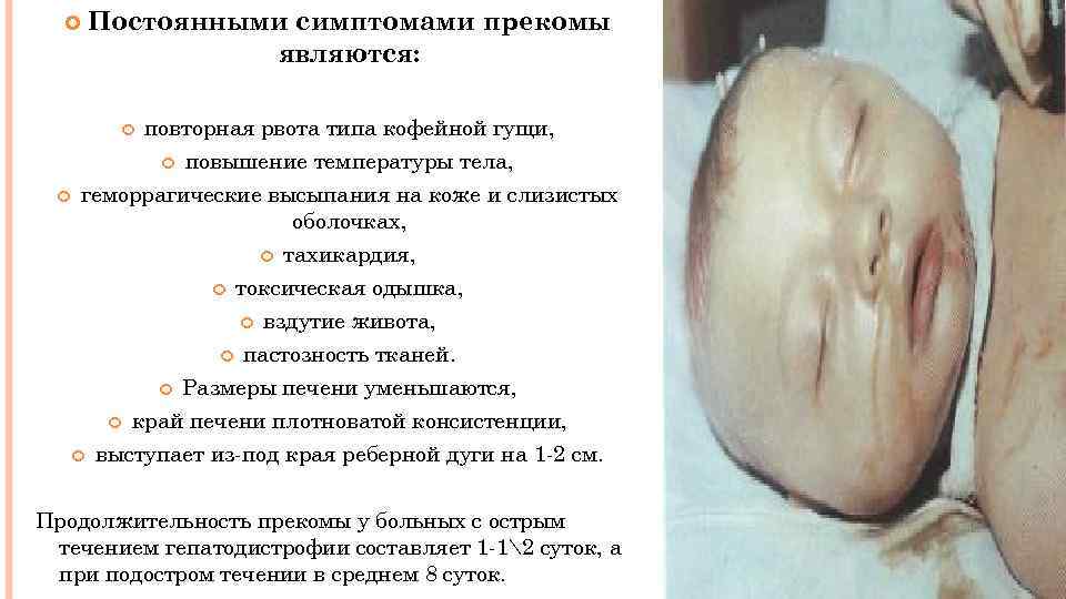  Постоянными симптомами прекомы являются: повторная рвота типа кофейной гущи, повышение температуры тела, геморрагические