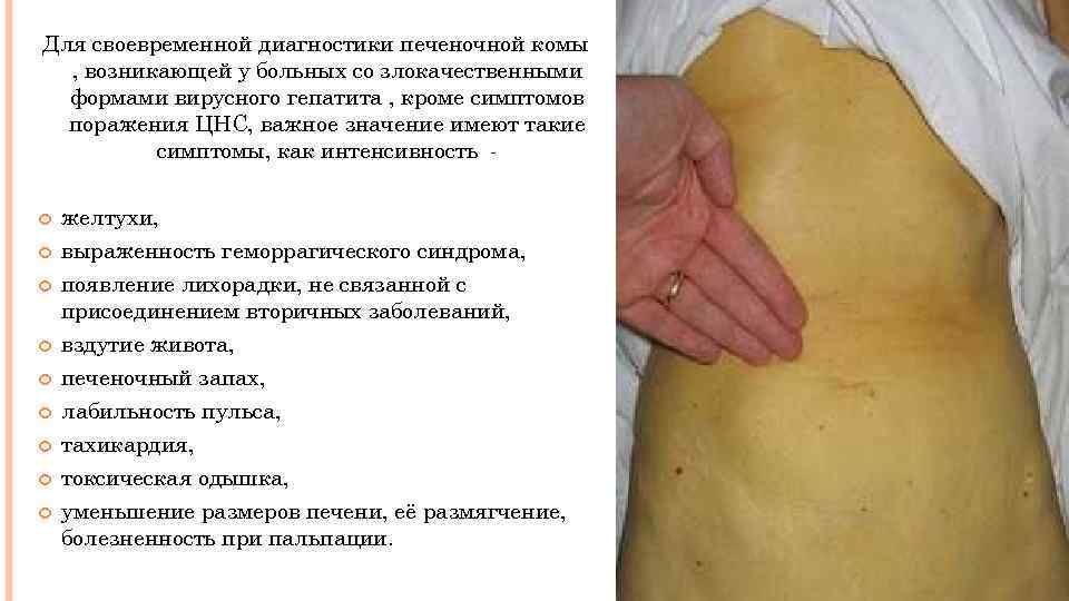 Для своевременной диагностики печеночной комы , возникающей у больных со злокачественными формами вирусного гепатита