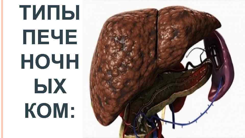 ТИПЫ ПЕЧЕ НОЧН ЫХ КОМ: 