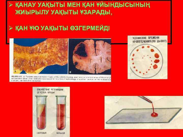 Ø ҚАНАУ УАҚЫТЫ МЕН ҚАН ҰЙЫНДЫСЫНЫҢ ЖИЫРЫЛУ УАҚЫТЫ ҰЗАРАДЫ, Ø ҚАН ҰЮ УАҚЫТЫ ӨЗГЕРМЕЙДІ