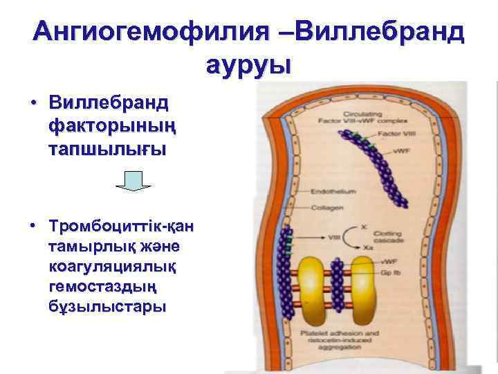 Ангиогемофилия –Виллебранд ауруы • Виллебранд факторының тапшылығы • Тромбоциттік-қан тамырлық және коагуляциялық гемостаздың бұзылыстары