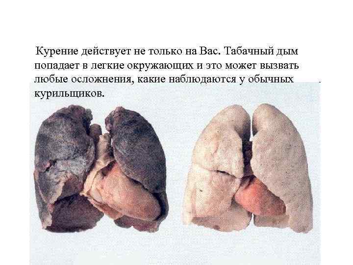 Курение действует не только на Вас. Табачный дым попадает в легкие окружающих и это