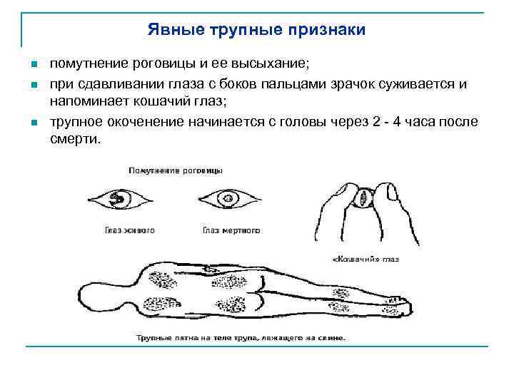 Явные трупные признаки n n n помутнение роговицы и ее высыхание; при сдавливании глаза