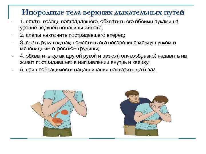 Инородные тела верхних дыхательных путей - - 1. встать позади пострадавшего, обхватить его обеими