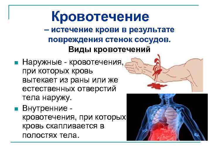 Кровотечение – истечение крови в результате повреждения стенок сосудов. Виды кровотечений n n Наружные