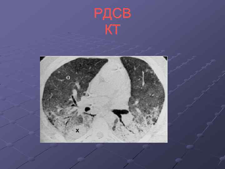 РДСВ КТ 