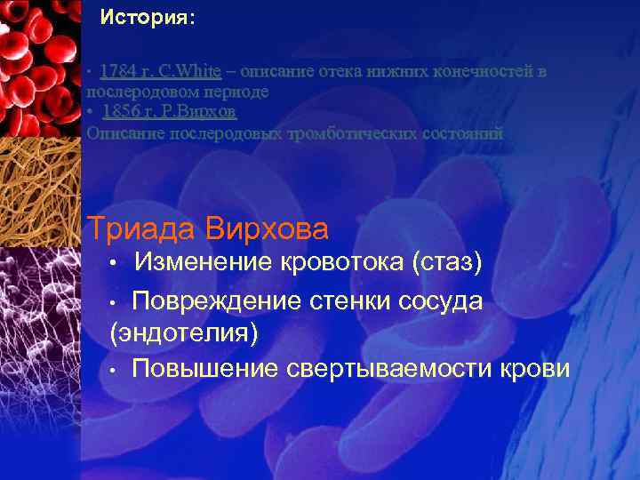 История: 1784 г. С. White – описание отека нижних конечностей в послеродовом периоде •