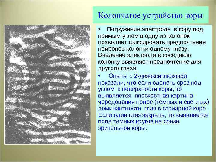 Колончатое устройство коры • Погружение электрода в кору под прямым углом в одну из
