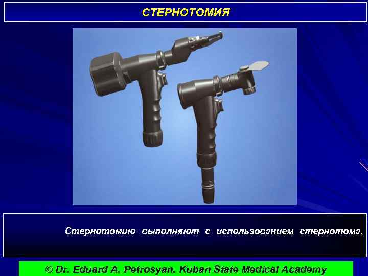 СТЕРНОТОМИЯ Стернотомию выполняют с использованием стернотома. © Dr. Eduard A. Petrosyan. Kuban State Medical