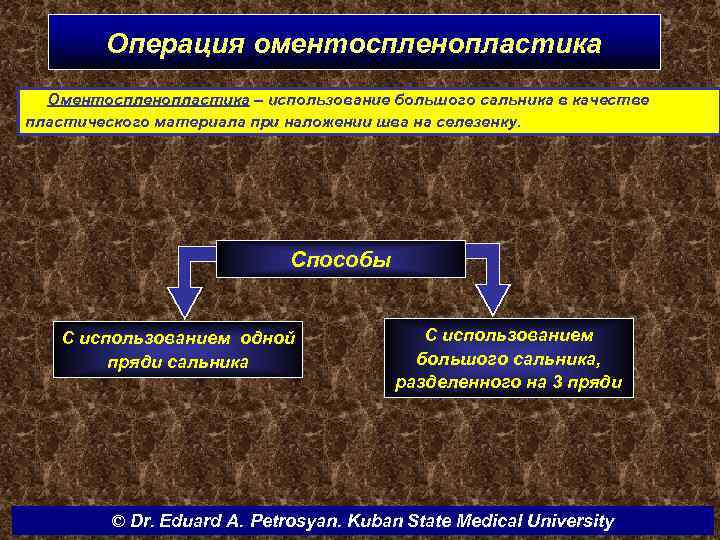 Операция оментоспленопластика Оментоспленопластика – использование большого сальника в качестве пластического материала при наложении шва