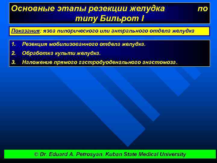 Основные этапы резекции желудка типу Бильрот I Показания: язва пилорического или антрального отдела желудка