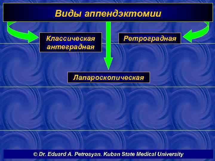 Виды аппендэктомии Классическая антеградная Ретроградная Лапароскопическая © Dr. Eduard A. Petrosyan. Kuban State Medical