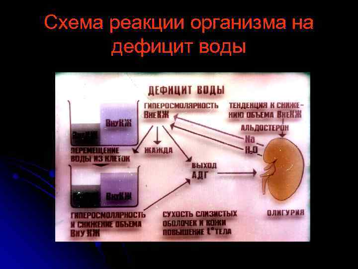 Схема реакции организма на дефицит воды 
