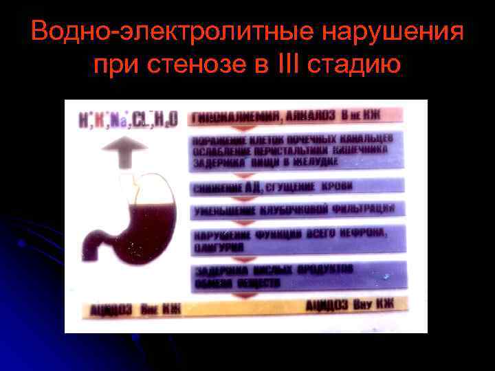 Водно-электролитные нарушения при стенозе в III стадию 