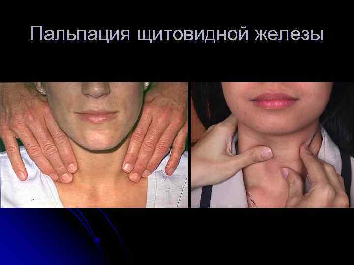 Пальпация щитовидной железы 