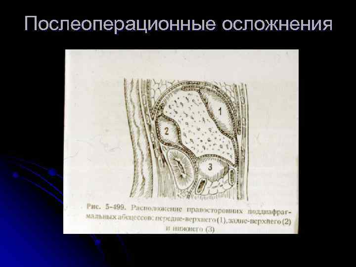 Послеоперационные осложнения 