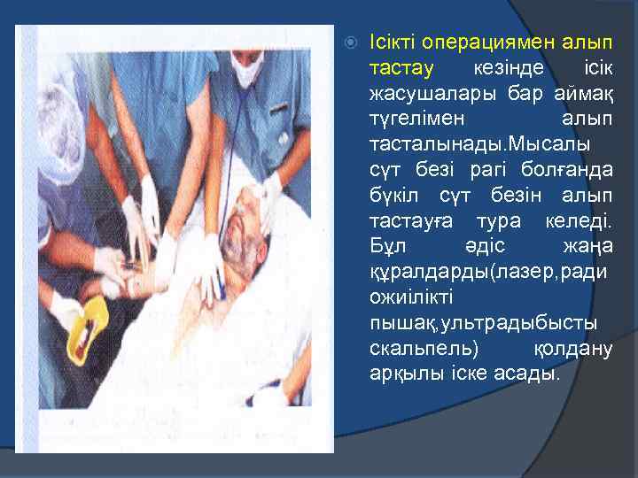 Ісікті операциямен алып тастау кезінде ісік жасушалары бар аймақ түгелімен алып тасталынады. Мысалы