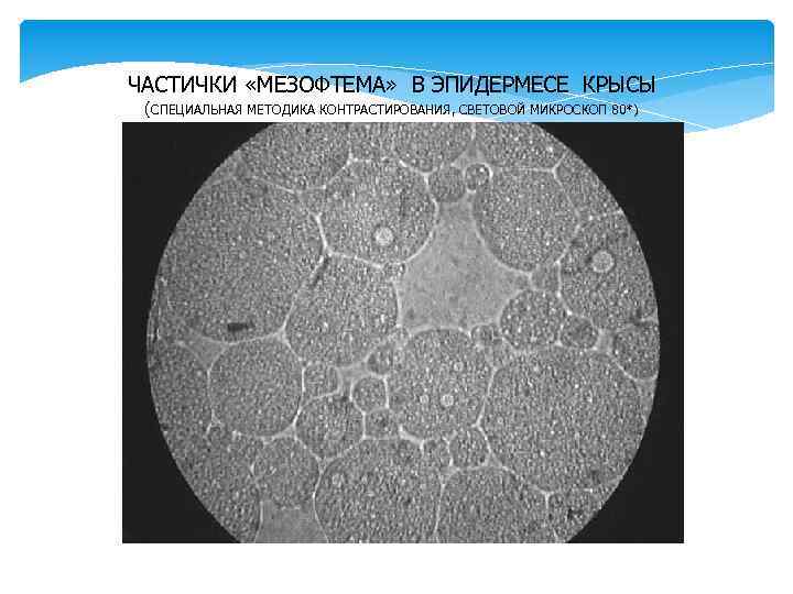 ЧАСТИЧКИ «МЕЗОФТЕМА» В ЭПИДЕРМЕСЕ КРЫСЫ (СПЕЦИАЛЬНАЯ МЕТОДИКА КОНТРАСТИРОВАНИЯ, СВЕТОВОЙ МИКРОСКОП 80*) 