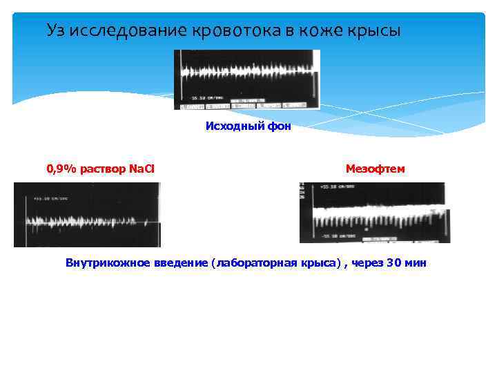 Уз исследование кровотока в коже крысы Исходный фон 0, 9% раствор Na. Cl Мезофтем