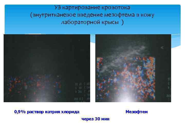 УЗ картирование кровотока (внутритканевое введение мезофтема в кожу лабораторной крысы ) 0, 9% раствор