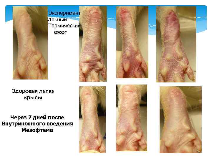 Эксперимент альный Термический ожог Здоровая лапка крысы Через 7 дней после Внутрикожного введения Мезофтема