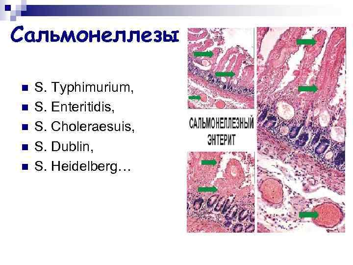 Сальмонеллезы n n n S. Typhimurium, S. Enteritidis, S. Choleraesuis, S. Dublin, S. Heidelberg…