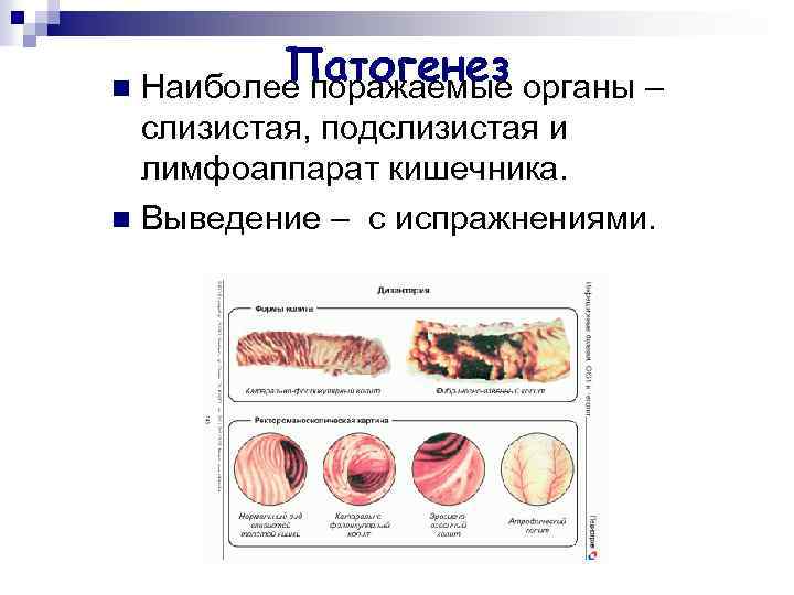 Патогенез органы – n Наиболее поражаемые слизистая, подслизистая и лимфоаппарат кишечника. n Выведение –