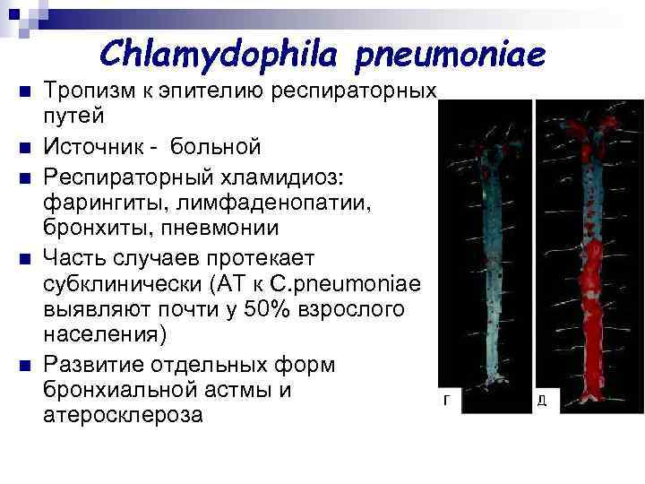 Chlamydophila pneumoniae n n n Тропизм к эпителию респираторных путей Источник - больной Респираторный