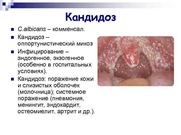 Кандидоз n n C. albicans – комменсал. Кандидоз – оппортунистический микоз Инфицирование – эндогенное,