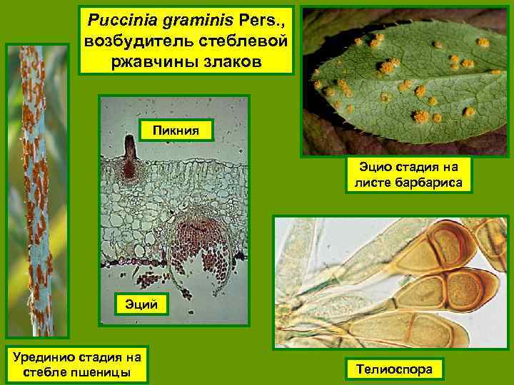 Puccinia graminis Pers. , возбудитель стеблевой ржавчины злаков Пикния Эцио стадия на листе барбариса