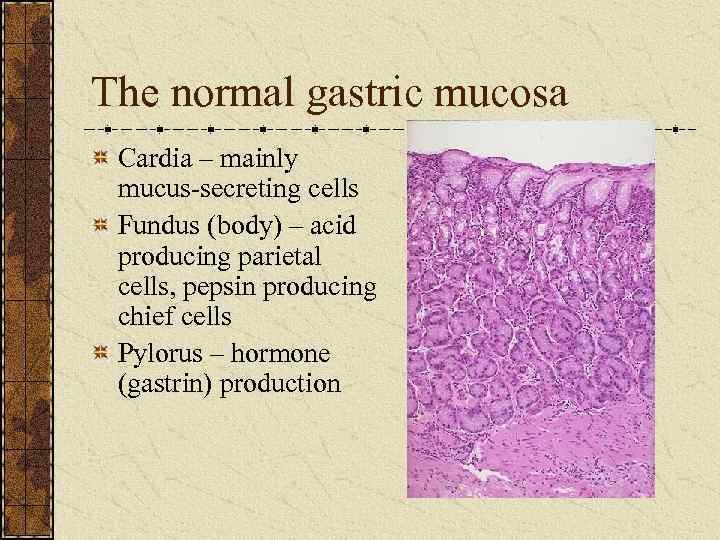 The normal gastric mucosa Cardia – mainly mucus-secreting cells Fundus (body) – acid producing